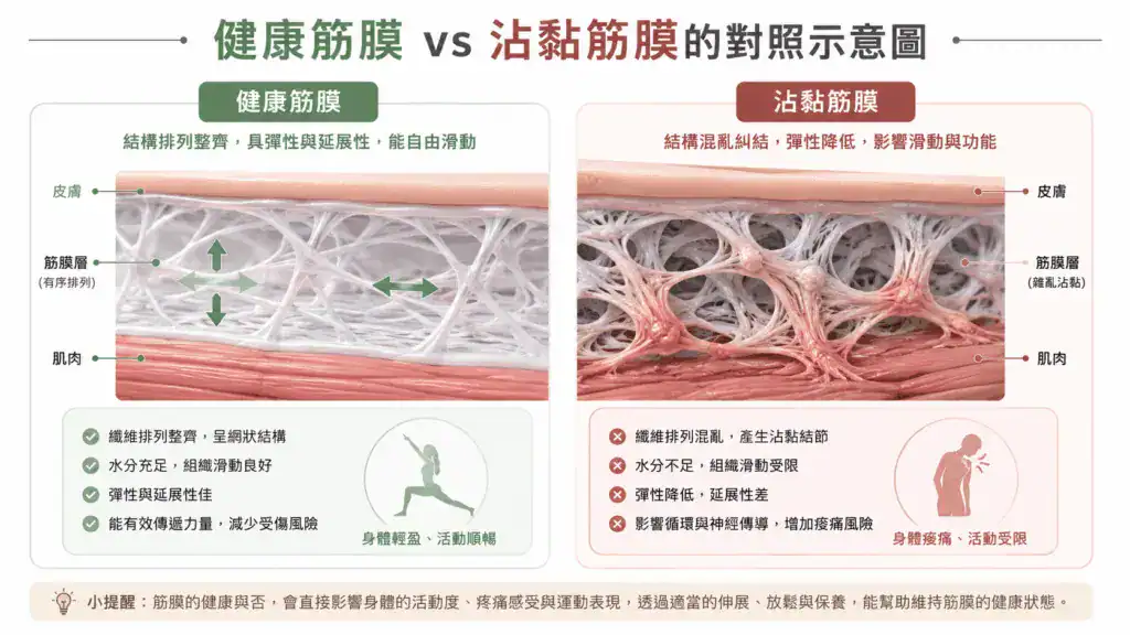 健康筋膜 vs 沾黏筋膜的對照示意圖