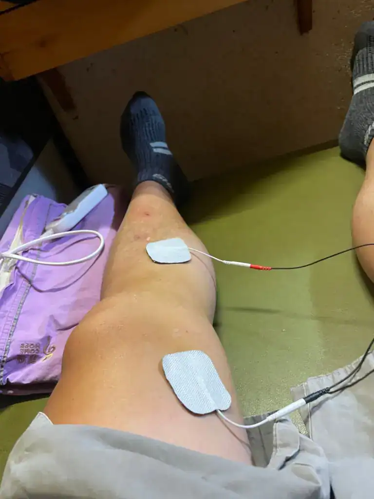 小針刀治療後電療15分鐘