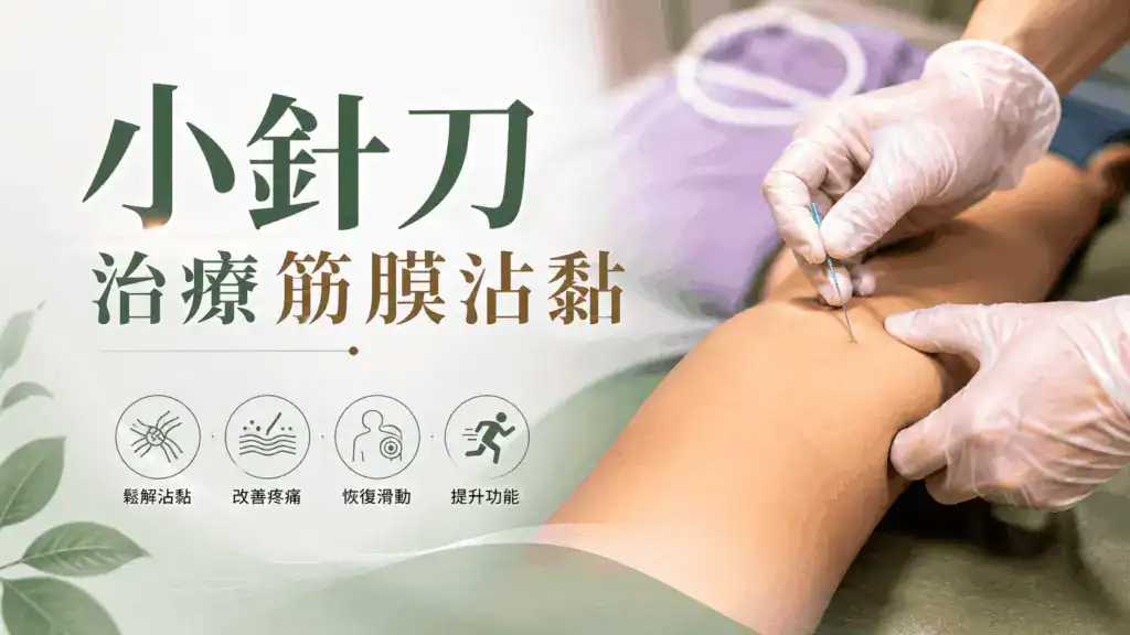 小針刀治療筋膜沾黏