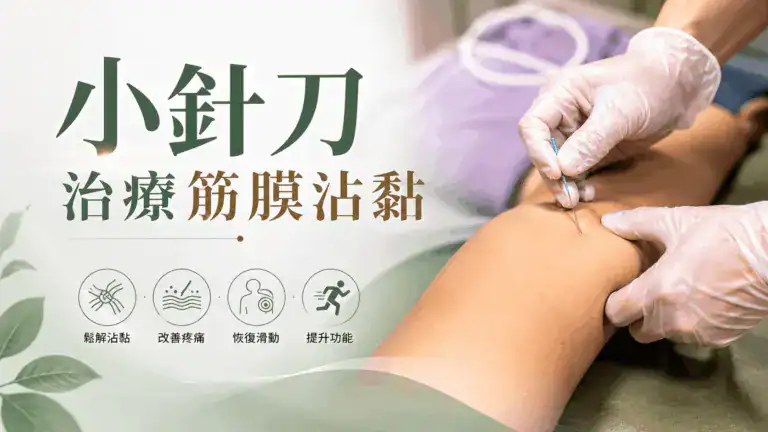 小針刀治療筋膜沾黏