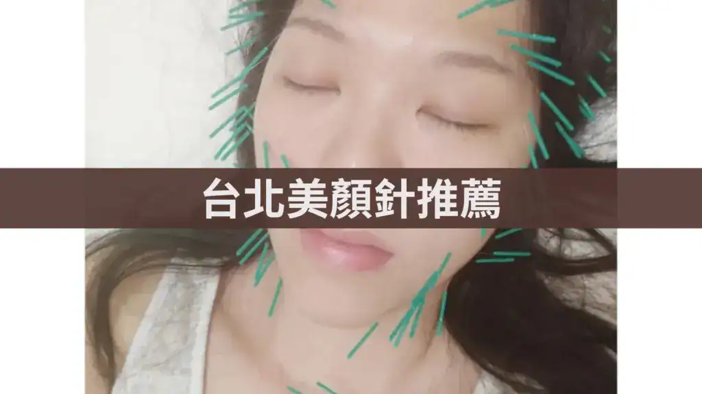 台北美顏針推薦